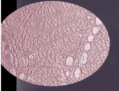 Ƥ��ѹ����